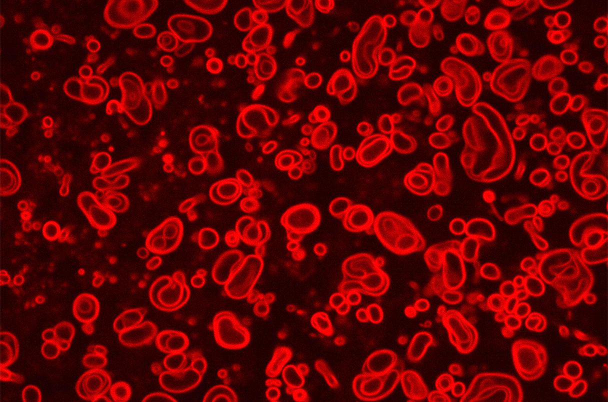 _20241029_cell_membranes_origin